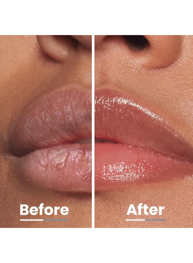 هايفن مرطب الشفاه "هايفن أول آي نيد" مع عامل حماية من الشمس 30 وحمض الكوجيك بنسبة 2% - ترطيب وحماية من الشمس | شفاه ناعمة، إزالة التصبغات للرجال والنساء | بلسم شفاه مع عامل حماية من الشمس | للشفاه الجافة والمتشققة | يحتوي على الببتيدات | نباتي، خالي من الكبريتات والبارابين - 10 جرام - Image 4